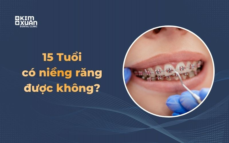 15 tuổi niềng răng có được không