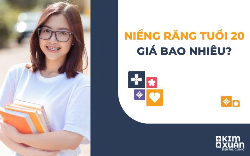 20 Tuổi Niềng Răng Giá Bao Nhiêu