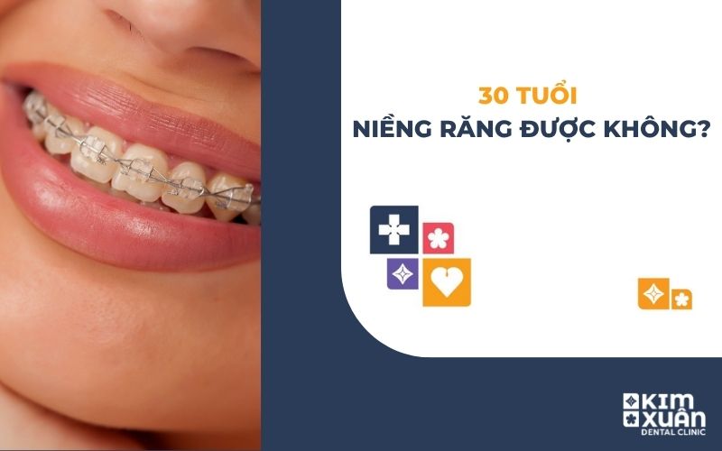 30 Tuổi Niềng Răng Được Không