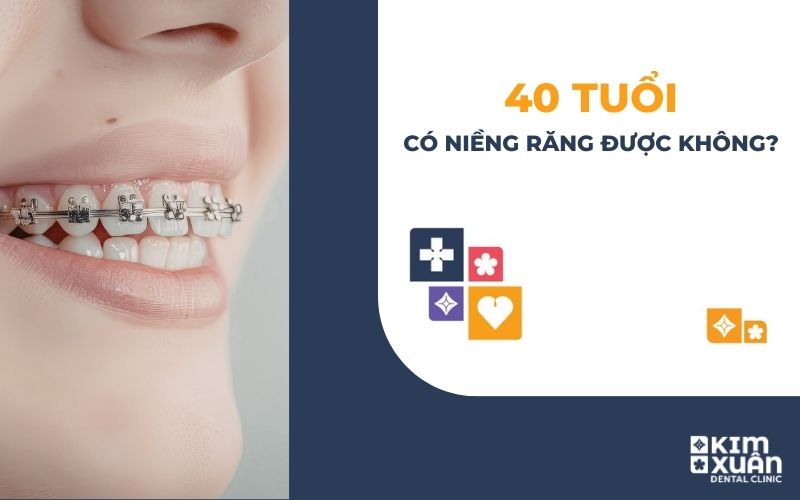 40 Tuổi Có Niềng Răng Được Không