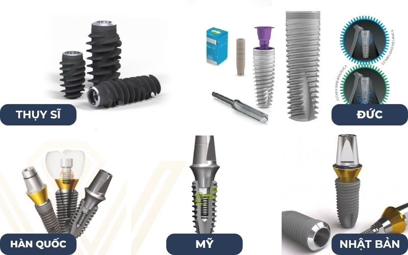 Bảng Giá Trồng Răng Implant Tại Nha Khoa Kim Xuân
