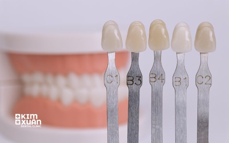 Bảng So Màu Khi Bọc Răng Sứ