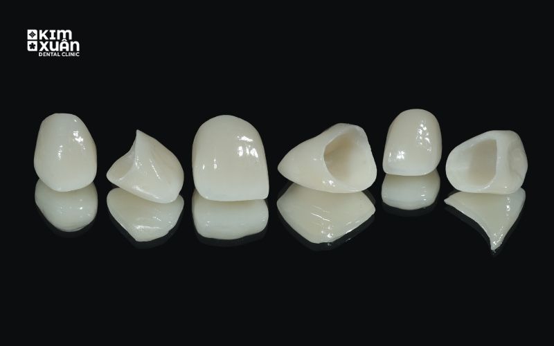 Bọc Răng Sứ