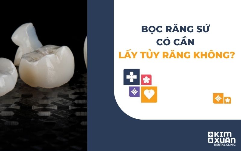 Bọc Răng Sứ Có Cần Lấy Tủy Không