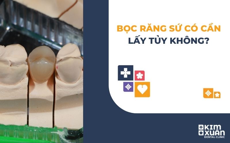 Bọc Răng Sứ Có Cần Lấy Tủy Răng Không