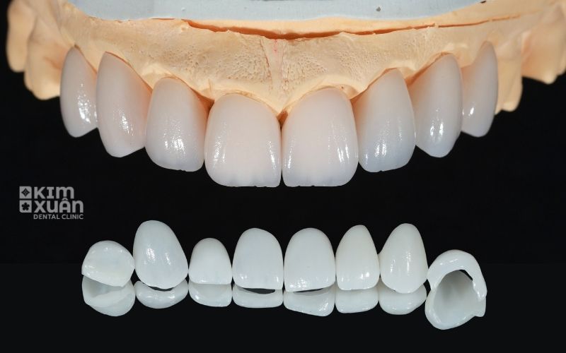 Bọc răng sứ có làm yếu răng không