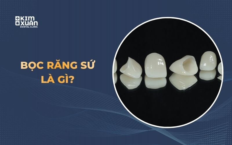 Bọc Răng Sứ Khi Nào