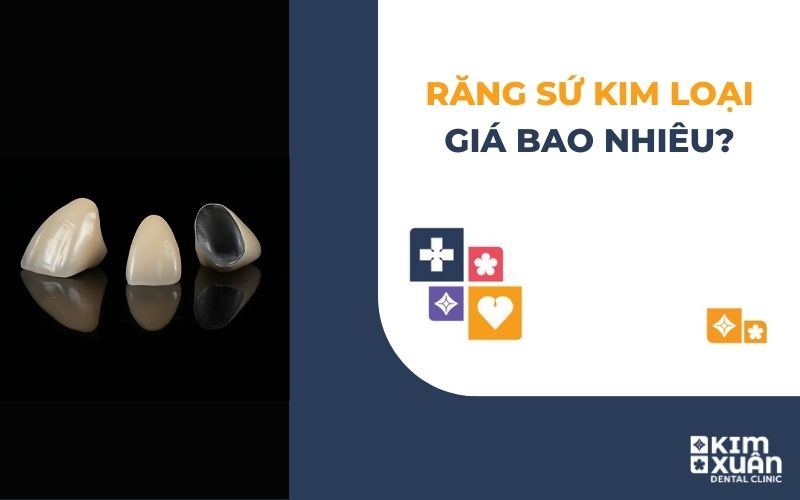 Bọc Răng Sứ Kim Loại Giá Bao Nhiêu Tiền