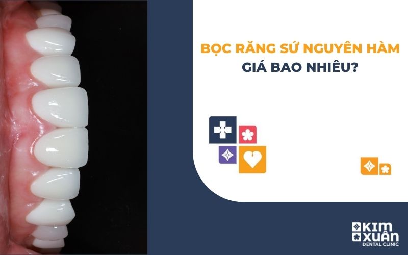 Bọc Răng Sứ Nguyên Hàm Giá Bao Nhiêu
