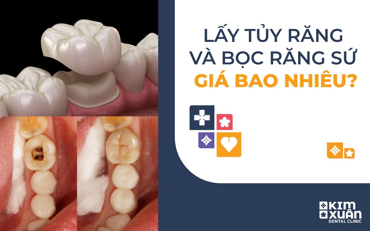 Bọc Răng Sứ Sau Khi Lấy Tủy Giá Bao Nhiêu