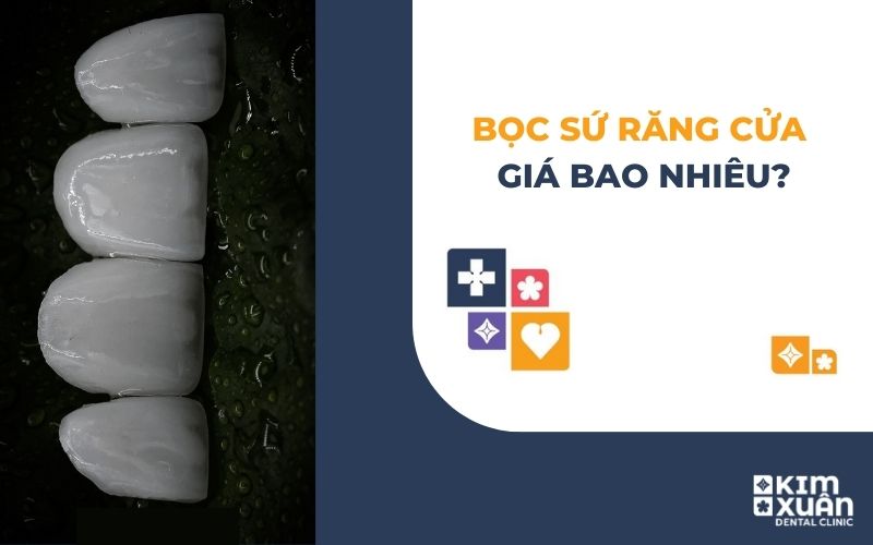 Bọc Sứ Răng Cửa Giá Bao Nhiêu