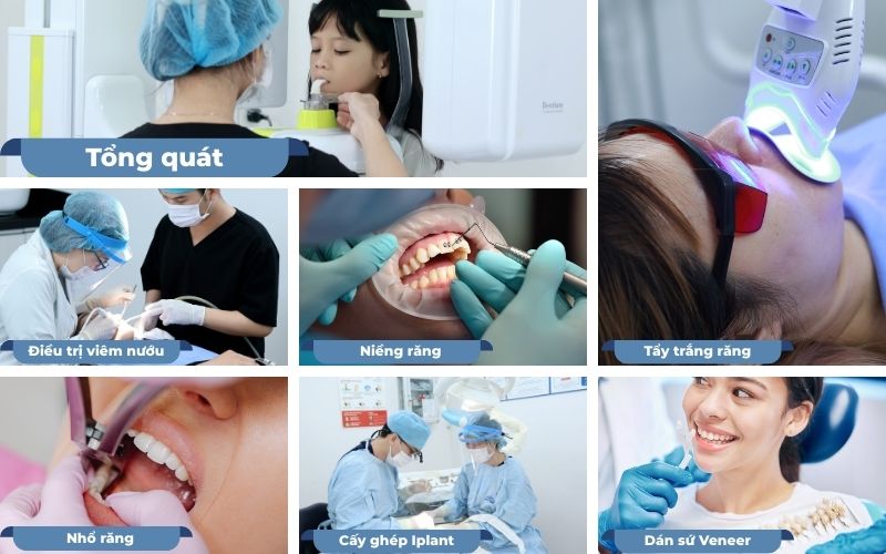 Các Dịch Vụ Nha Khoa Uy Tín Tại TP. HCM 