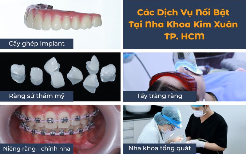 Các Dịch Vụ Tại Nha Khoa Kim Xuân