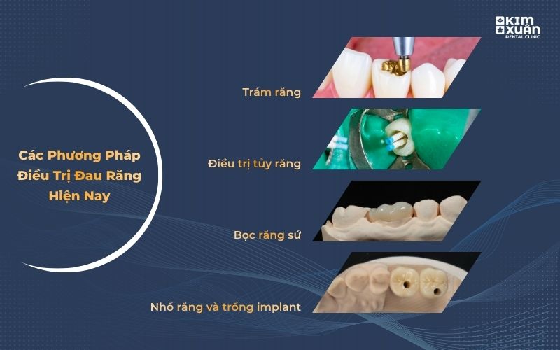 Các Phương Pháp Điều Trị Đau Răng Phổ Biến Hiện Nay