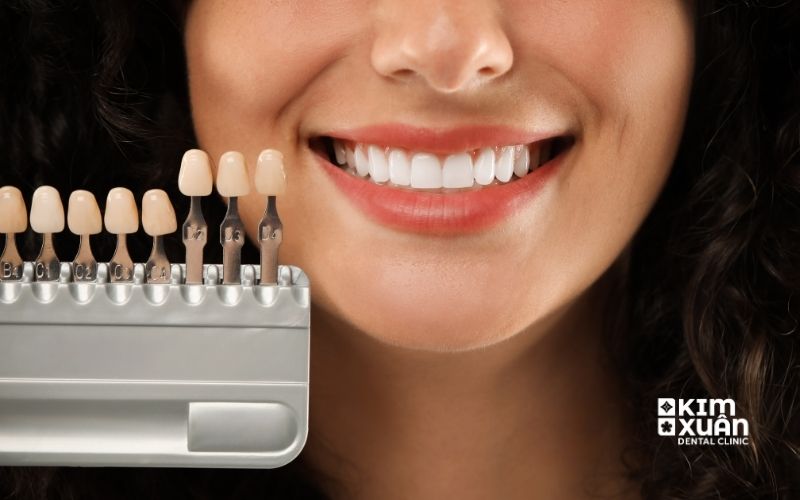 Các Yếu Tố Ảnh Hưởng Đến Giá Dán Răng Sứ