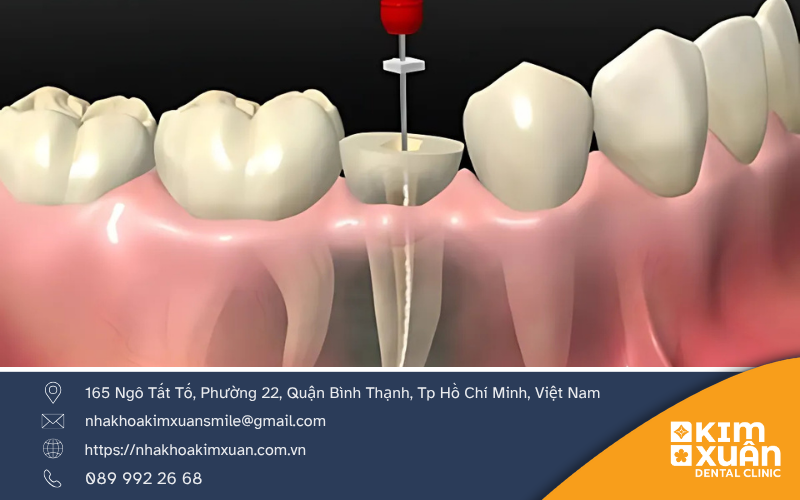 Các Yếu Tố Ảnh Hưởng Đến Số Lần Lấy Tủy