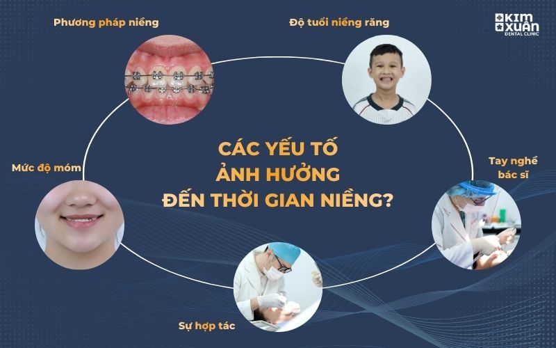 Các Yếu Tố Ảnh Hưởng Đến ThờiGian Niềng Răng Móm 