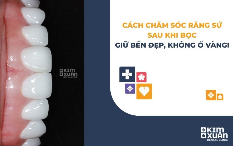 Cách Chăm Sóc Răng Sứ Sau Khi Bọc