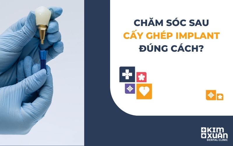 Cách Chăm Sóc Sau Khi Cấy Ghép Implant