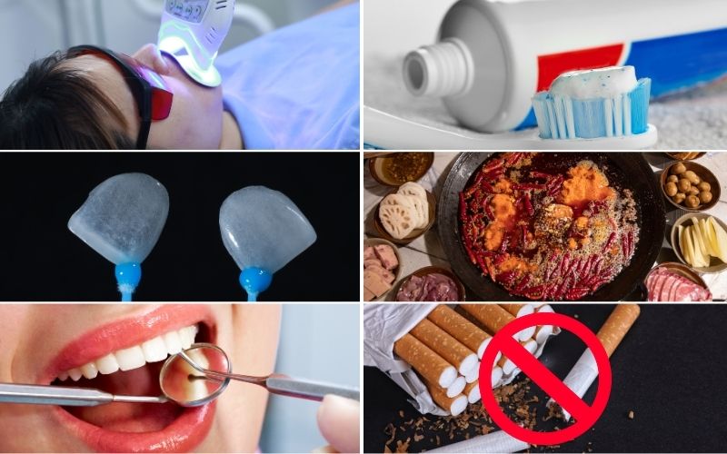 Cách Điều Trị Răng Bị Ố Vàng Hiệu Quả