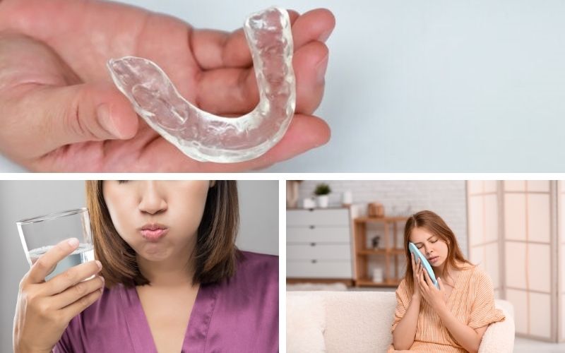 Cách Giảm Ê Buốt Sau Khi Bọc Răng Sứ
