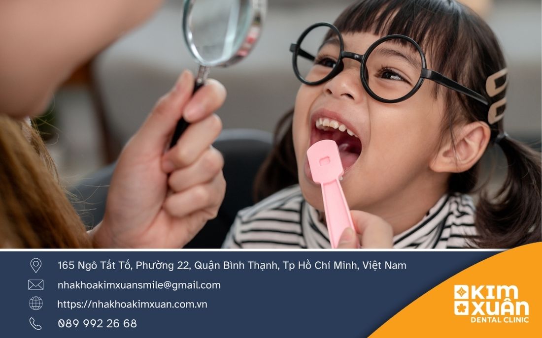 Cách Phòng Tránh Sâu Răng Ở Trẻ Em