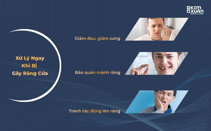 Cách Xử Lý Khi Gãy Răng Cửa