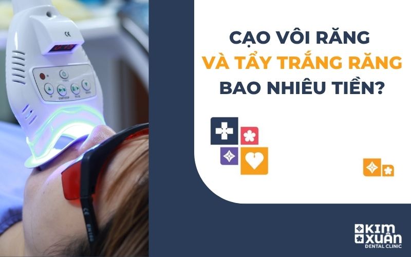 Cạo Vôi Răng Và Tẩy Trắng Răng Giá Bao Nhiêu Tiền