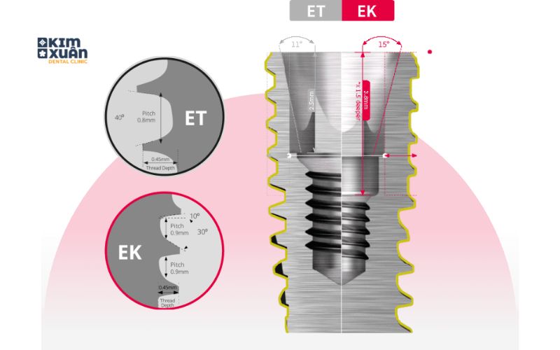 Cấu Tạo Trụ Implant Hiossen