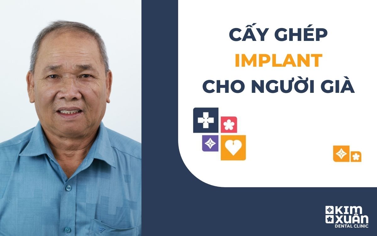 Cấy Ghép Implant Cho Người Già
