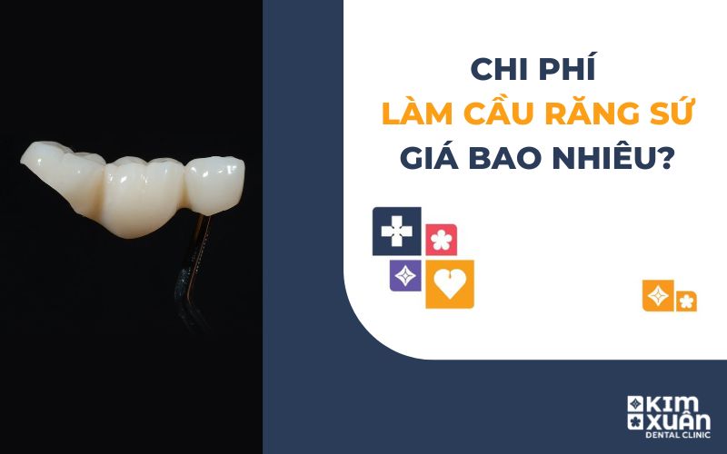 Chi Phí Làm Cầu Răng Sứ Bao Nhiêu Tiền