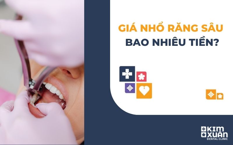 Chi Phí Nhổ Răng Giá Bao Nhiêu