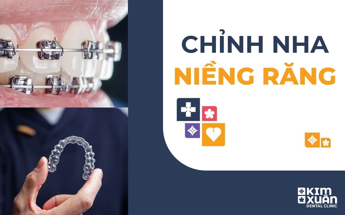 Chỉnh Nha Niềng Răng