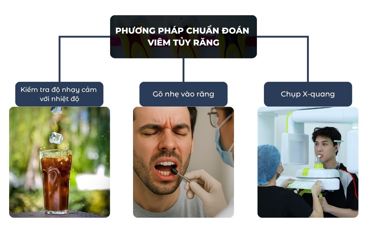 Cách Chuẩn Đoán Viêm Tủy Răng