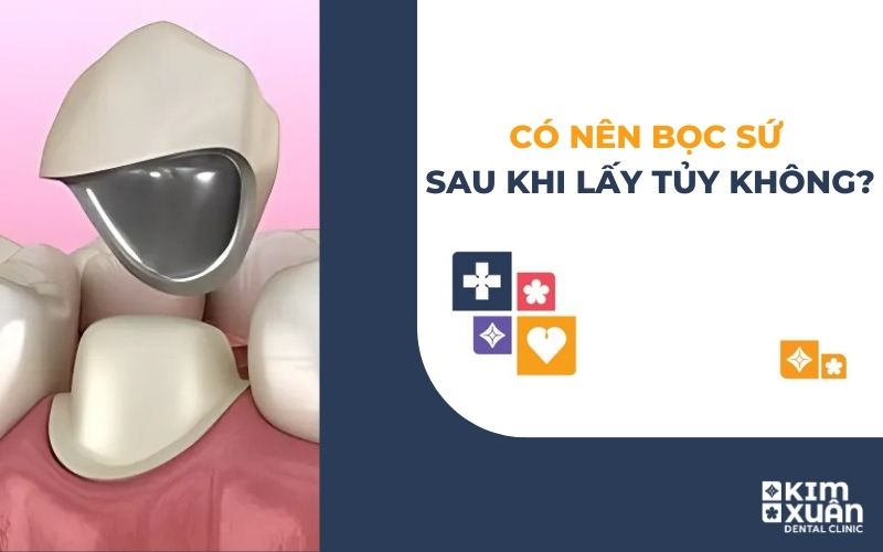 Có Nên Bọc Răng Sứ Sau Khi Lấy Tủy