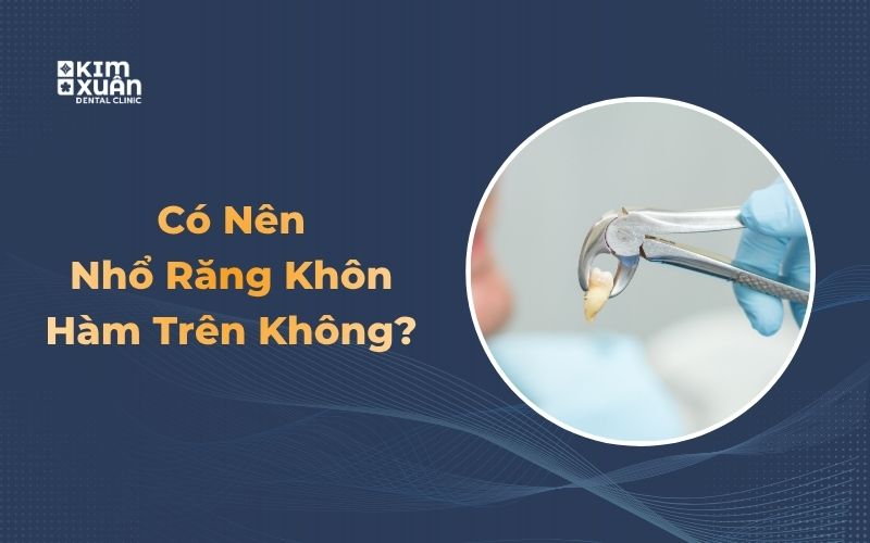 Có nên nhổ răng khôn hàm trên không