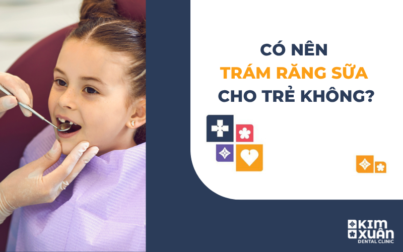 Có Nên Trám Răng Sữa Cho Trẻ Không