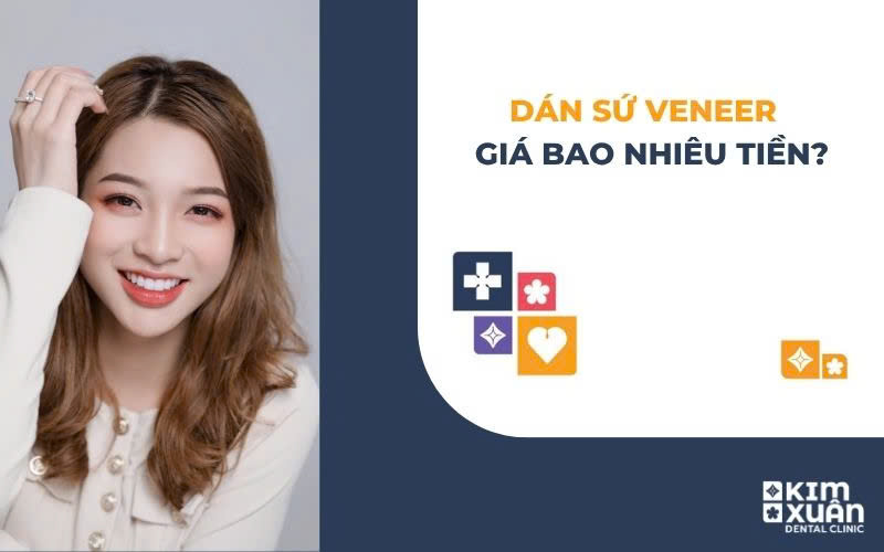 Dán Sứ Veneer Giá Bao Nhiêu