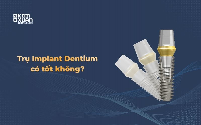 Thiết kế trụ Implant Dentium và các thành phần phục hình nha khoa.