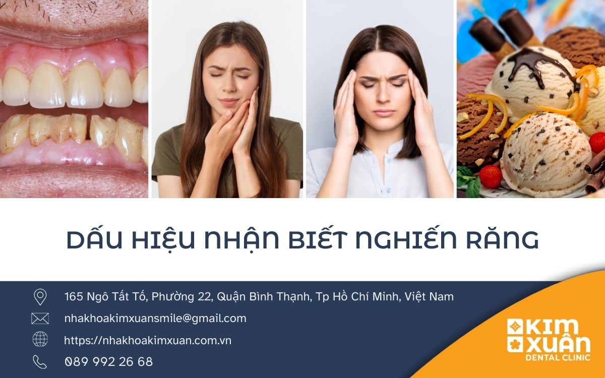Dấu Hiệu Nhận Biết Khi Nguyên Răng
