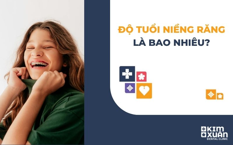 Độ Tuổi Niềng Răng Là Bao Nhiêu