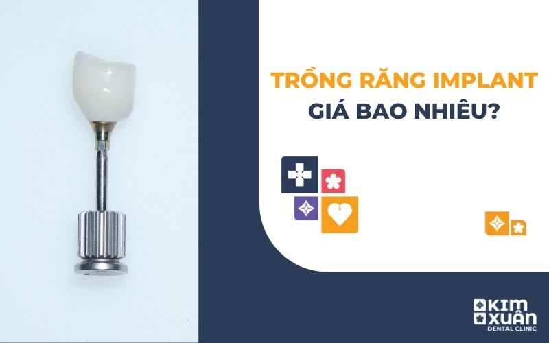 Giá Cấy Ghép Implant Bao Nhiêu Tiền