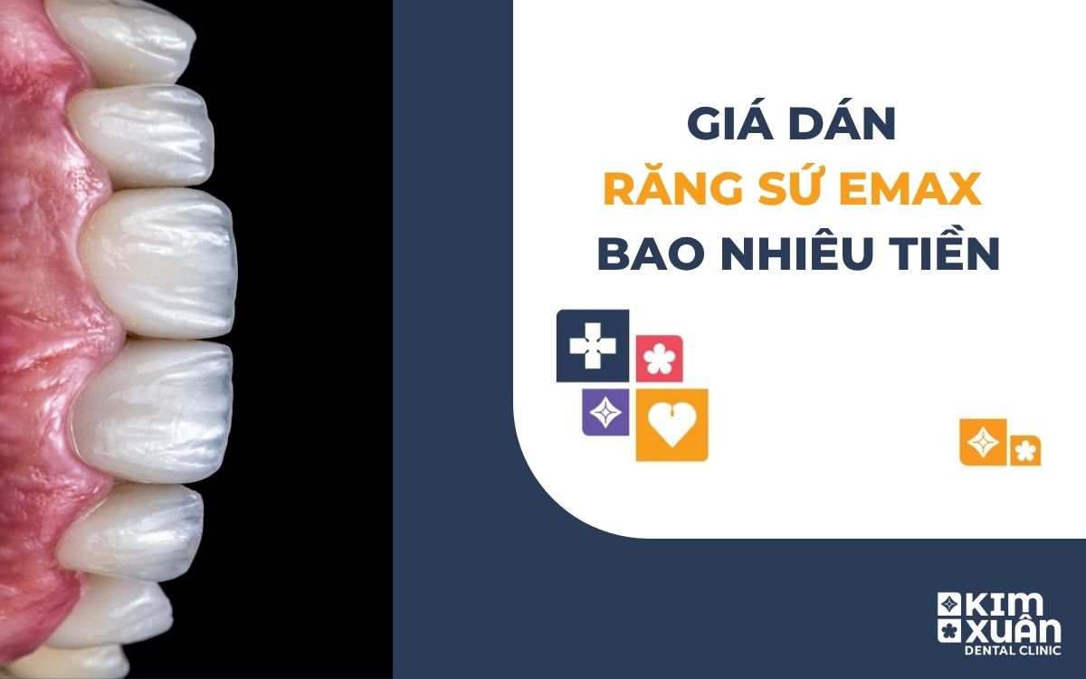 Giá Dán Răng Sư Emax Giá Bao Nhiêu