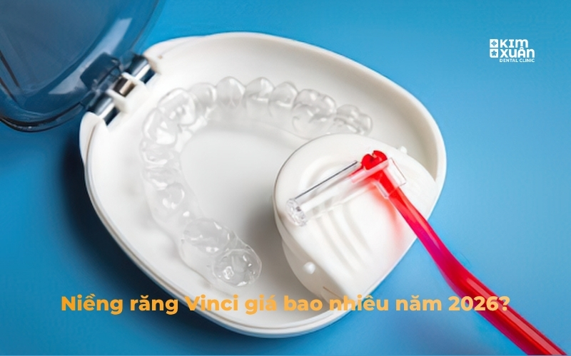 Niềng răng Vinci giá bao nhiêu