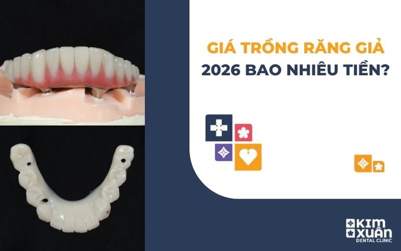 Giá Trồng Răng Giả Bao Nhiêu Tiền