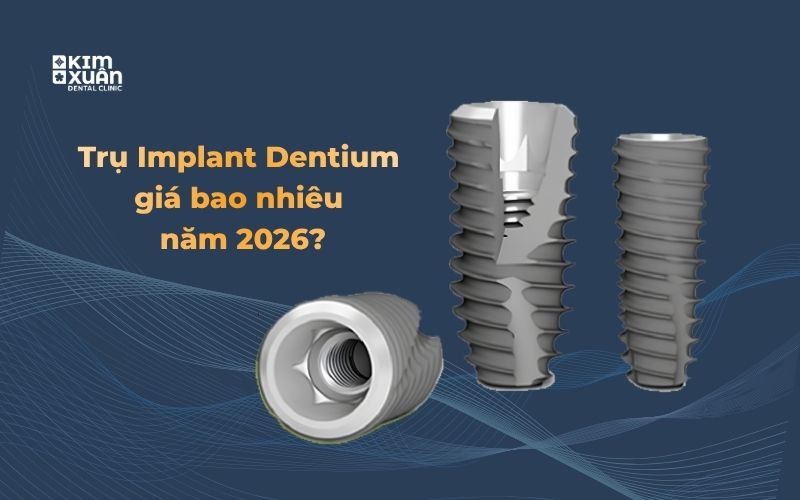 Implant Dentium giá bao nhiêu