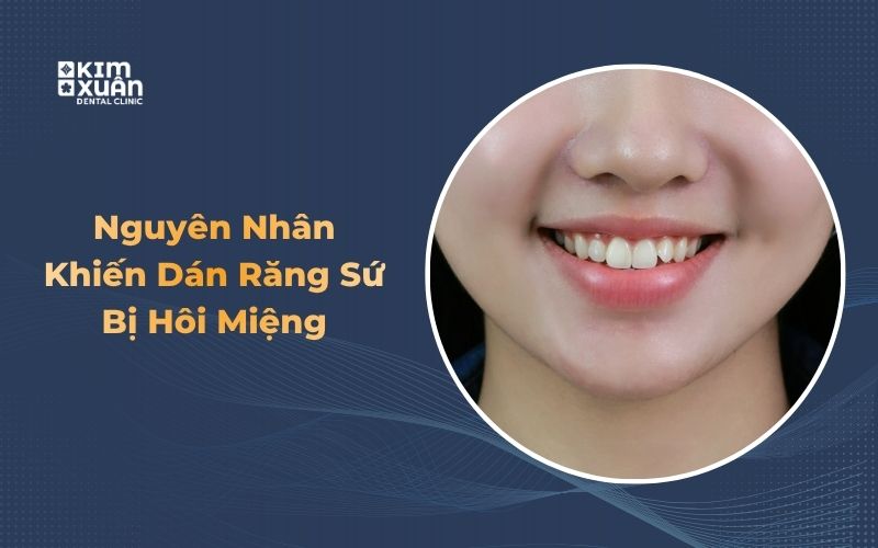 Hình Ảnh Dùng Sứ Kém Chất Lượng Gây Hôi Miệng