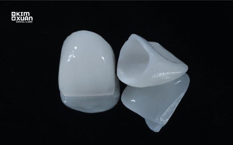 Hình Ảnh Răng Sứ Toàn Sứ