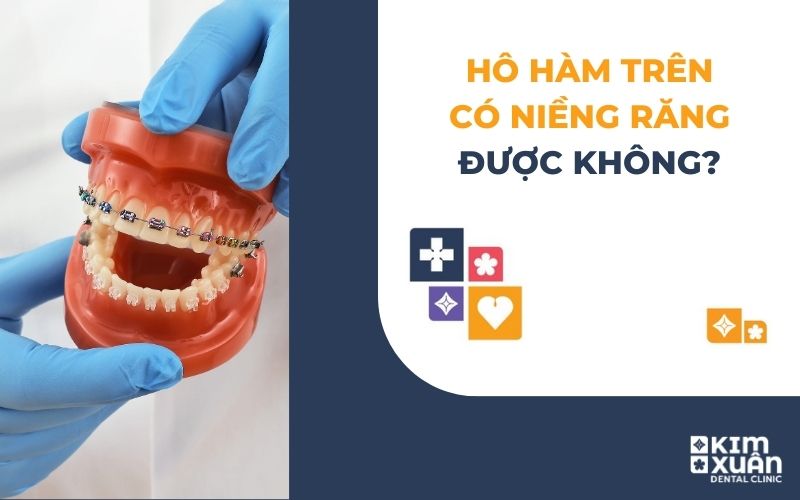 Hô Hàm Trên Có Niềng Răng Được Không