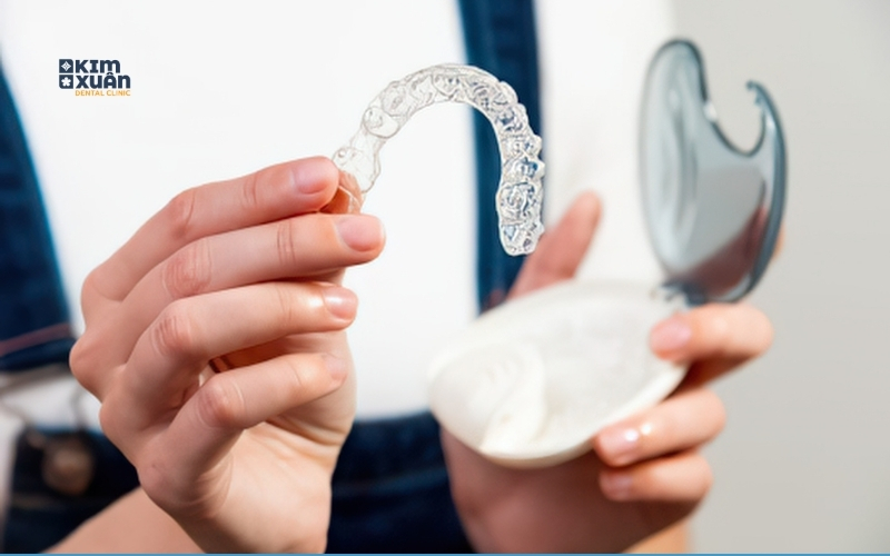 Khay niềng răng trong suốt có thể tháo lắp